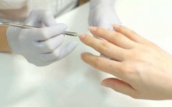  手指甲盖修复手术多少钱「指甲的修复期是多久」
