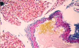 纤维素染色常用染料_纤维素染色 生物学