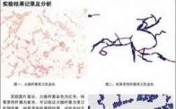 革兰染色和抗酸染色实验分析