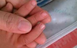 婴儿没有指甲盖后期会长吗?