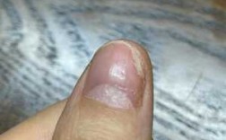 指甲表面有点凸凹不平是怎么回事 指甲表面凹凸不平怎么修复