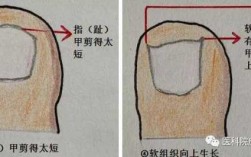 大拇指甲床在哪里