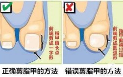 牛脚指甲修复方法图解-牛脚指甲修复方法