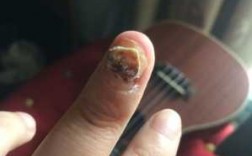 5厘米的指甲断了怎么修复_5厘米的指甲断了怎么修复好