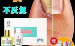  修复灰指甲用什么药最好使「修复灰指甲用什么药最好使用」