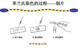 革兰染色所用的染料是什么颜色_革兰染色的原理和步骤分别是什么?