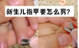  孩子的指甲盖怎么修复好「小孩指甲应该怎样修剪?」