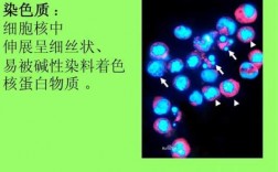  细胞核碱性染料染色「核仁被碱性染料染色」