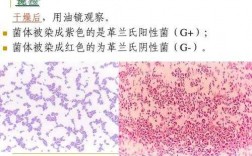 革兰染色法有什么实际意义-革兰染色法的染料是什么