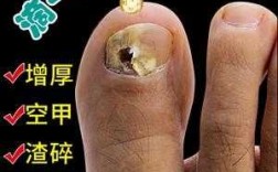 修复指甲用什么药好-修复指甲损伤图片大全图解