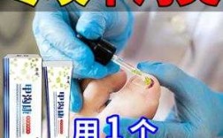  啃指甲用什么修复膏最好「啃指甲用什么药」