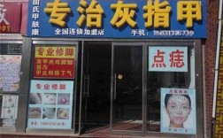 阜阳修复疤痕医院哪家最好-阜阳指甲矫正修复店哪家好