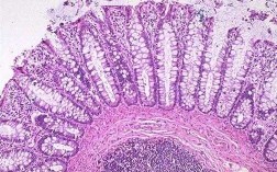 被碱性染料染色的细胞结构-能被碱性染料染色的有哪些