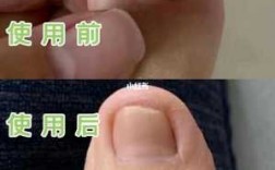 指甲 修复 修复手指甲甲床多少钱