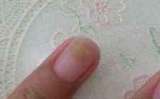 剥掉甲片怎么修复指甲凹凸不平,剥掉甲片发现指甲变绿图片 