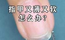 指甲软了如何修复好呢,指甲软的原因和处理方法 