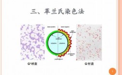 革兰氏染色方法的染料（革兰氏染色法的基本原理和步骤）