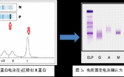 血清蛋白电泳染色的染料是,蛋白电泳染色原理 