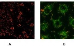 线粒体染色哪种染料好_线粒体染色剂