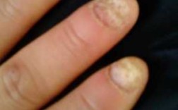 裂开的指甲如何修好 修复裂缝指甲多少钱啊一次