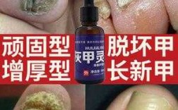 烂脚指甲修复_烂脚指甲用什么药好