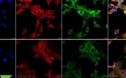 免疫荧光染色可以存放多久 免疫荧光染色细胞膜染料