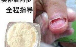  指甲裂开用什么药可以修复好「指甲裂开用什么药膏」