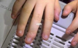 儿童指甲修复