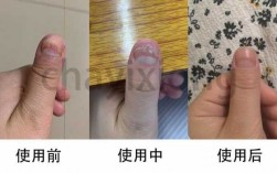 修复指甲有用吗知乎全文