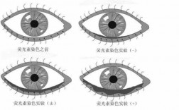 角膜染色是用什么染料