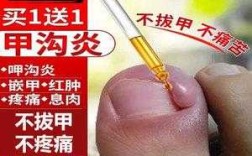 指甲伤口用什么药膏-指甲可以涂什么药修复伤口