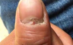 裂开的指甲如何修好