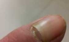指甲裂缝了-如何修复裂开指甲缝
