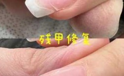 受损指甲修护怎么修复图片,指甲损伤修复 