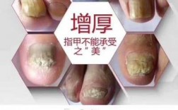 治疗灰指甲甲床受损应该怎么治疗-灰指甲的甲床可以自己修复吗