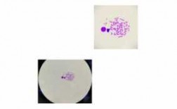  观察染色体实验的染料是「观察染色体用什么染色?」