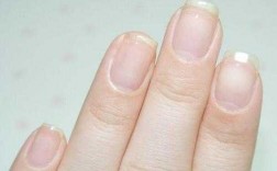 圆指甲盖怎么修复好的图片_圆指甲盖怎么修复好的图片