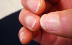  指甲断裂在家怎么修复好「指甲断裂有什么征兆」