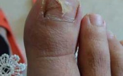  脚指甲软涂指甲油断了怎么修复「脚趾甲涂指甲油会变灰指甲吗」