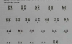 染色体筛查查的是哪里的染料