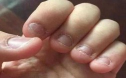 儿童啃指甲怎么修复好得快,儿童啃指甲有哪些危害 