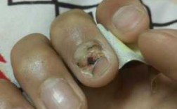 指甲坏了怎么修复好 指甲坏了怎么修复