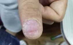 修复指甲的药膏 修复指甲的危害图片男士