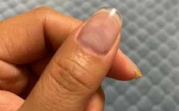  指甲受损修复长闭口多久「指甲恢复期大概多久」