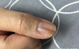  包上指甲痕印能修复吗「包上指甲痕印能修复吗」
