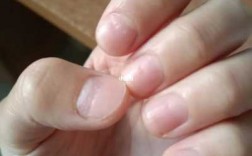 指甲折痕修复（指甲折痕修复多少钱）