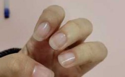 手指甲有白色划痕修复要多少钱 手指甲有白色划痕修复