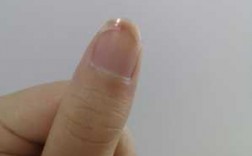 指甲劈裂如何治疗 指甲外力劈裂修复