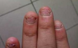 怎样修复啃完的指甲盖图片 怎样修复啃完的指甲盖