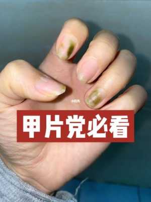 美甲片划了怎么修复不伤指甲_美甲片怎么弄掉-图3